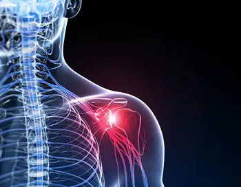 Frozen shoulder treatment in kingston
