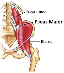 Tight psoas can be a cause of back pain
